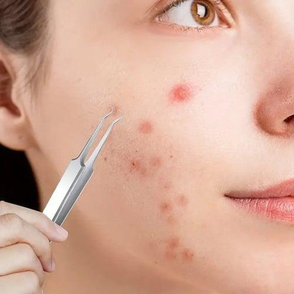 Multifunktional Mitesserentferner-Set